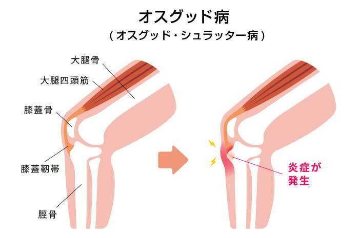 足立区綾瀬で子供の靴選びでお悩みのあなたへ　東京都足立区東綾瀬　ライフ整骨院の代田です。